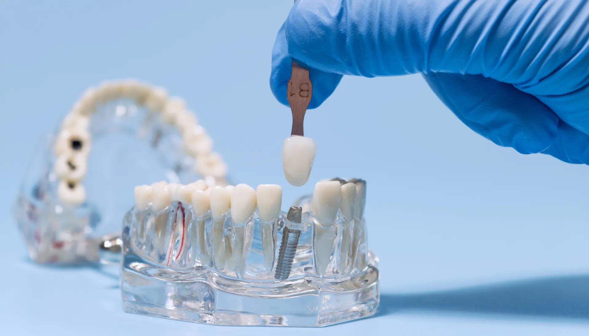 Computer-guided implant surgery